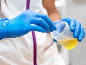 Is It Safe to Drink Your Urine?