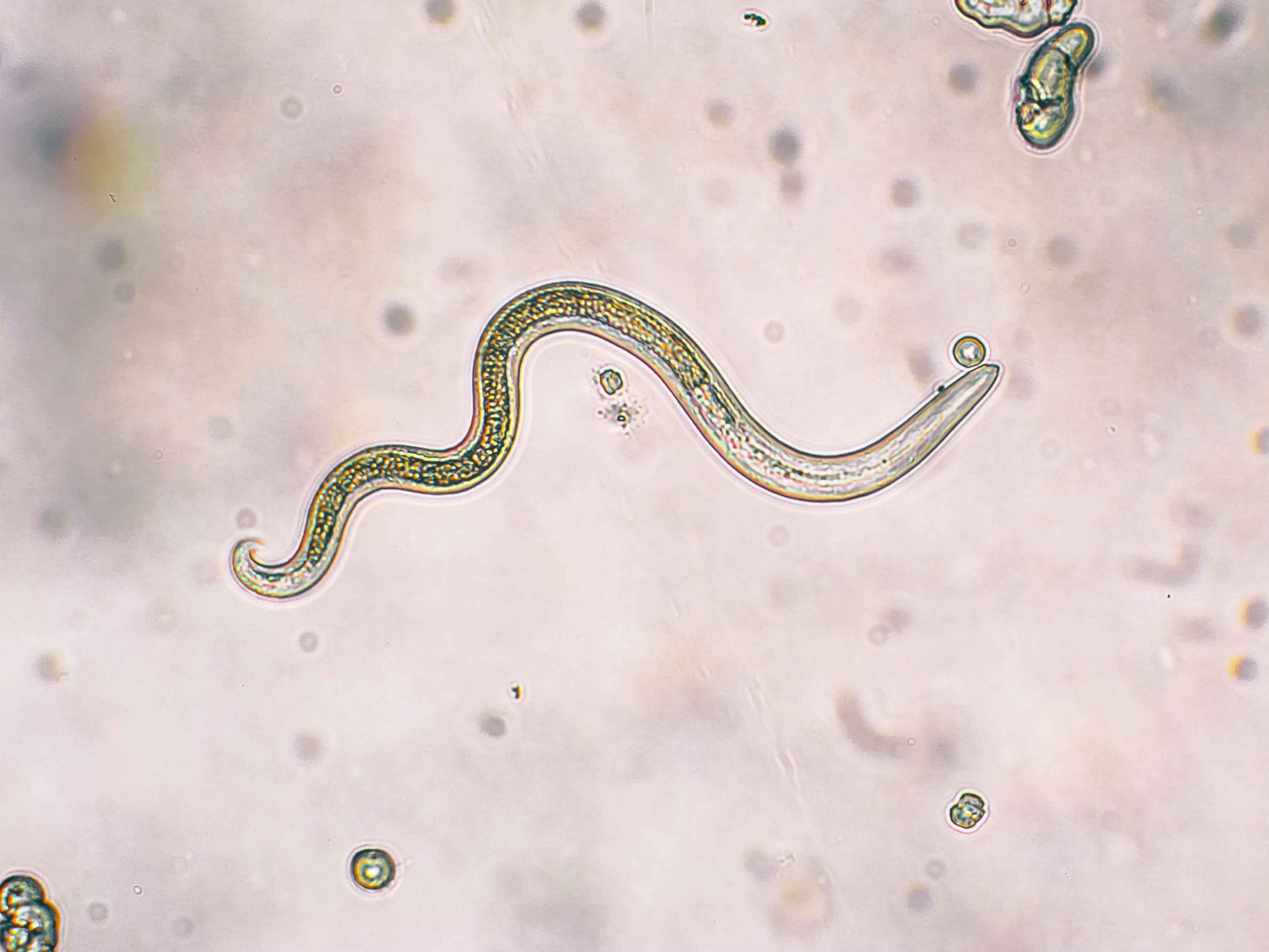 roundworm