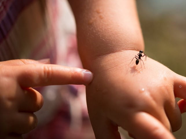 baby hand with ant stings