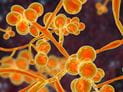 Is There a Treatment for Candida auris?