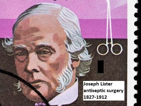 joseph lister