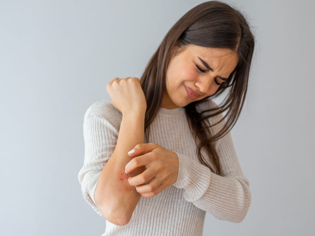 woman scratches itch on her arm