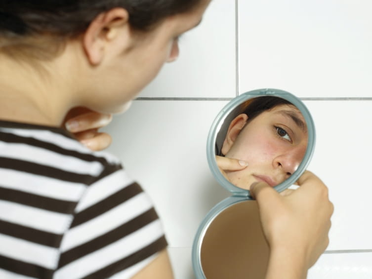 Acne treatment sharethis share topical