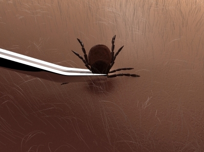 lyme 1